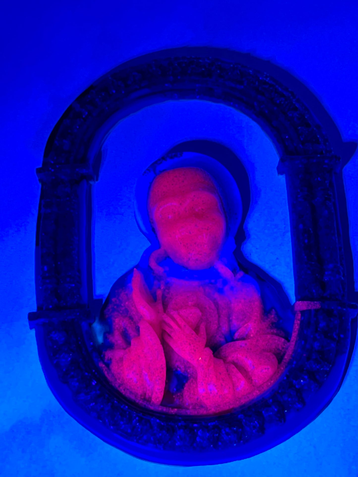 Bootleg Jesus Ape: Wisdom Tooth Differential